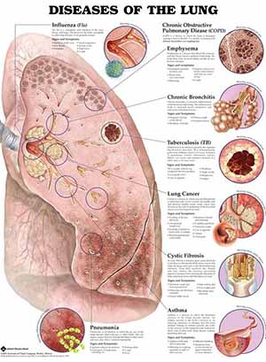 Chronic Disorder 4